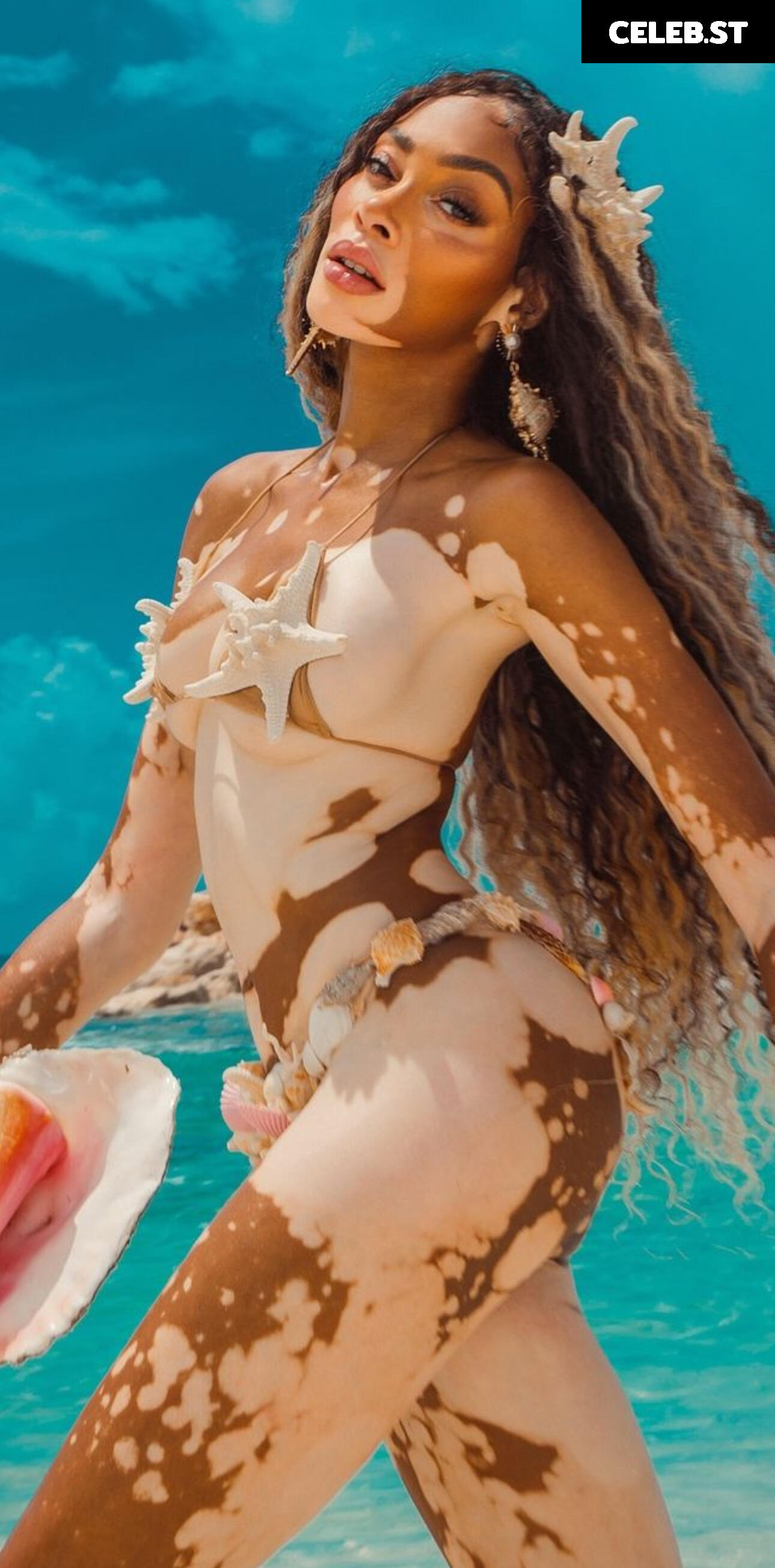 Winnie Harlow Image 1739869