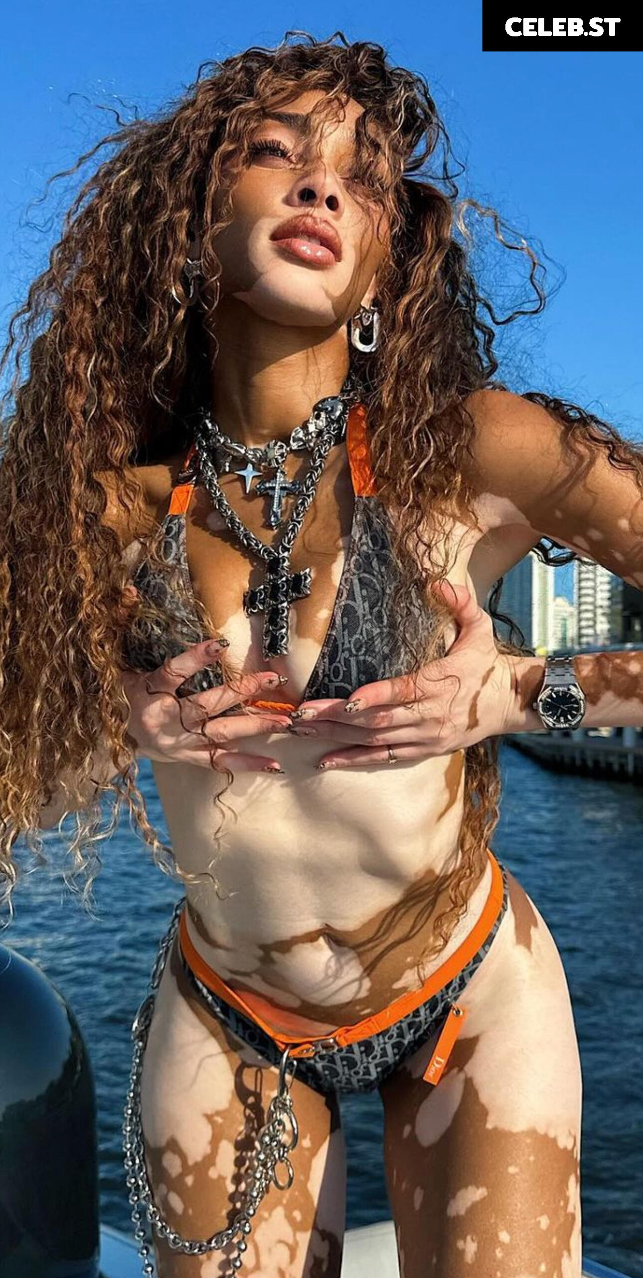 Winnie Harlow Image 1739513