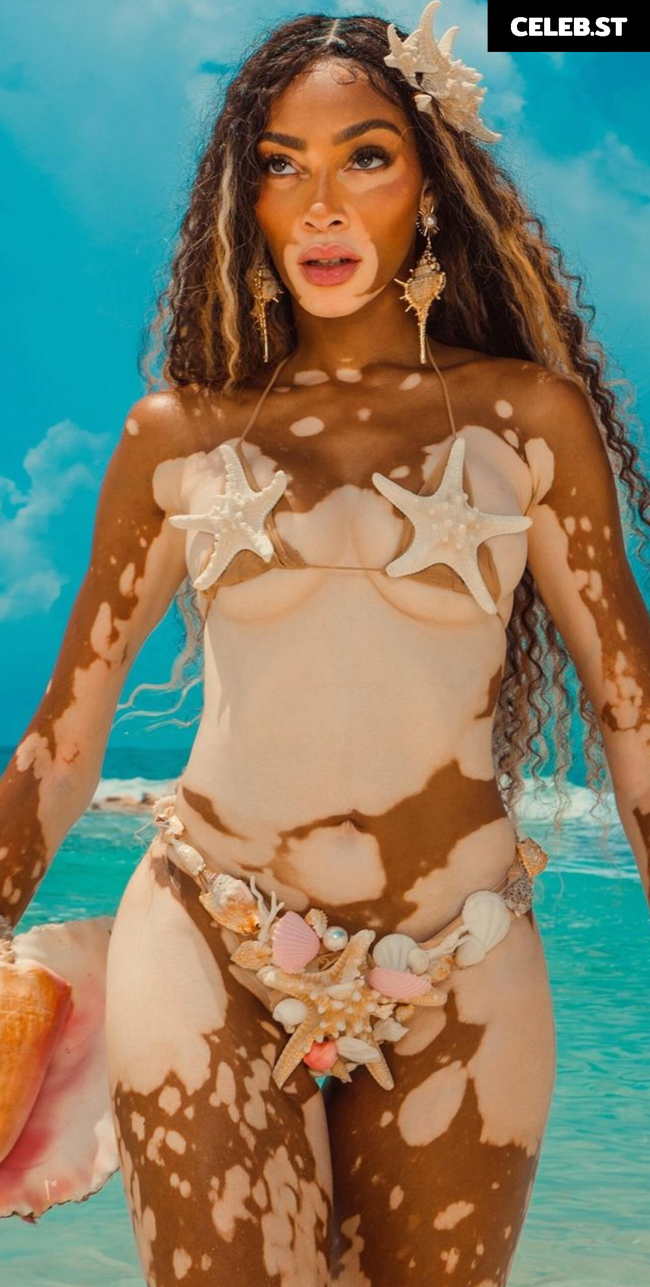 Winnie Harlow Image 1739782