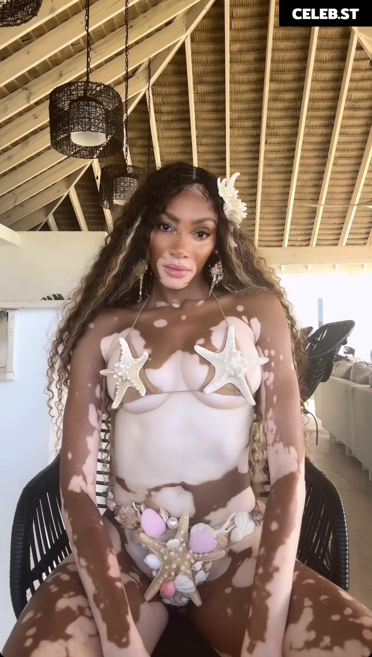 Winnie Harlow Image 1739707