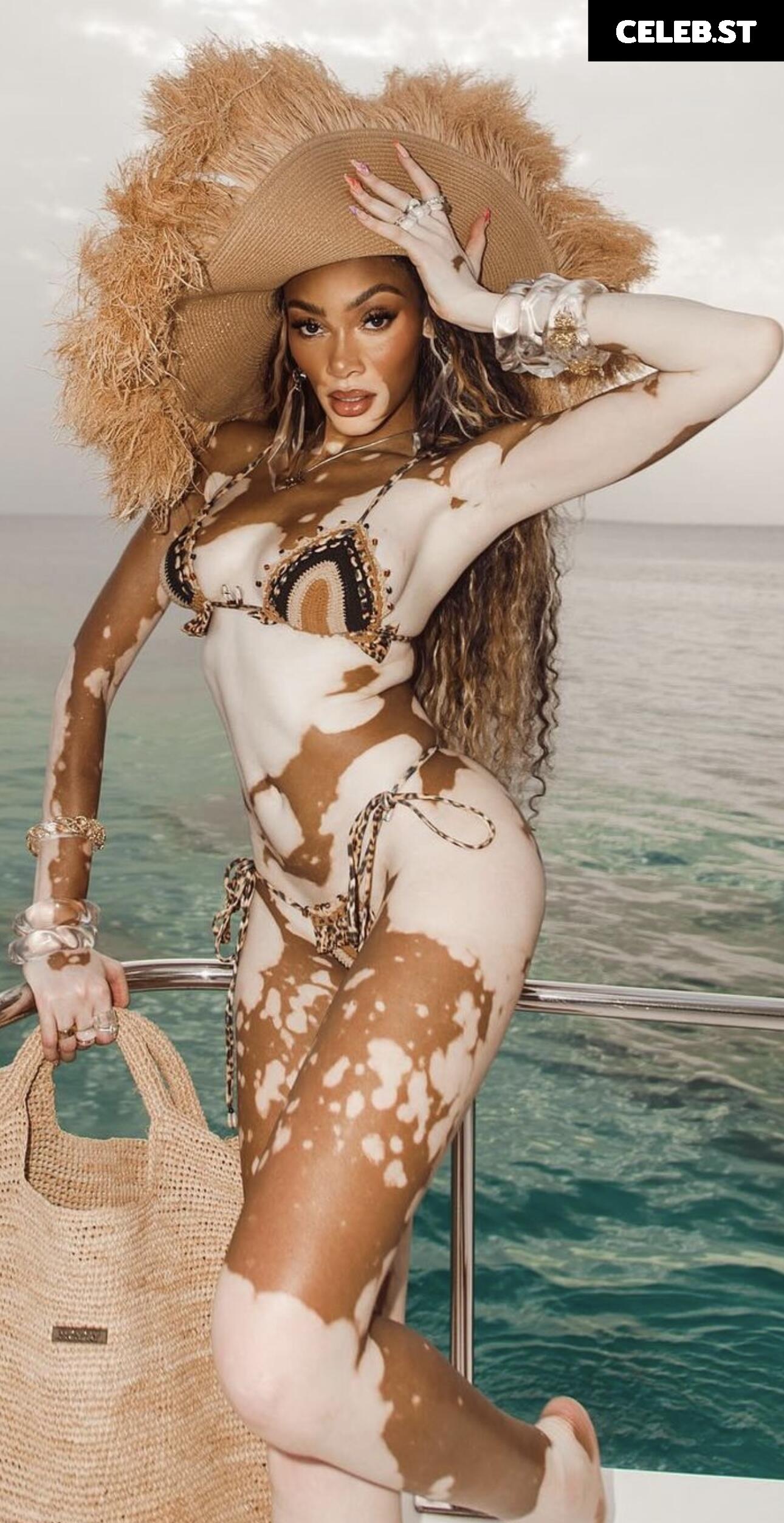 Winnie Harlow Image 1739601
