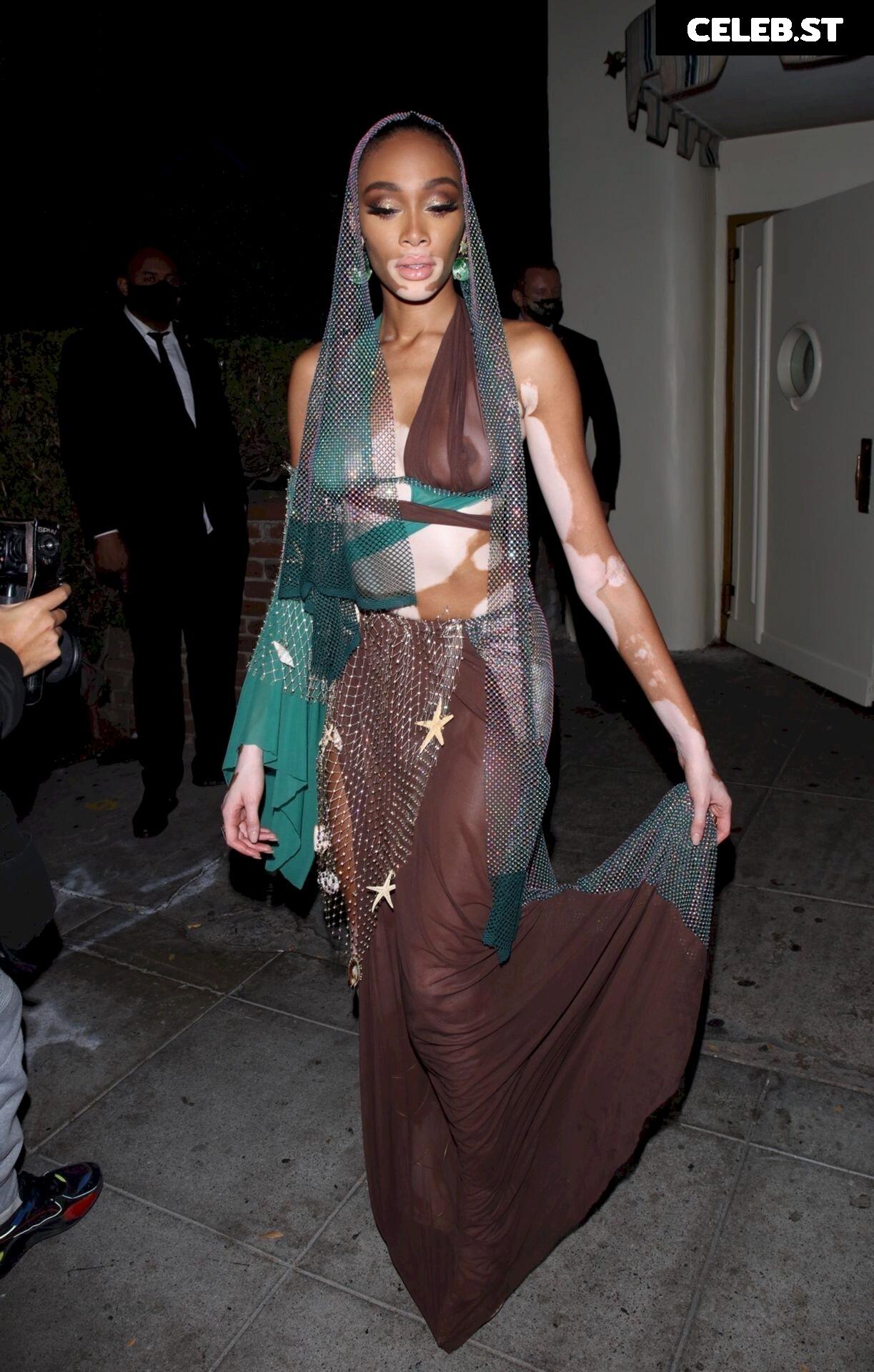 Winnie Harlow Image 1739001