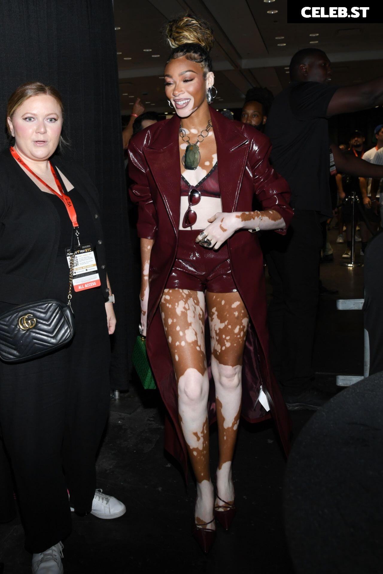 Winnie Harlow Image 1738579