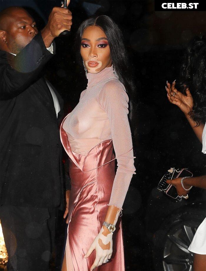 Winnie Harlow Image 1738730