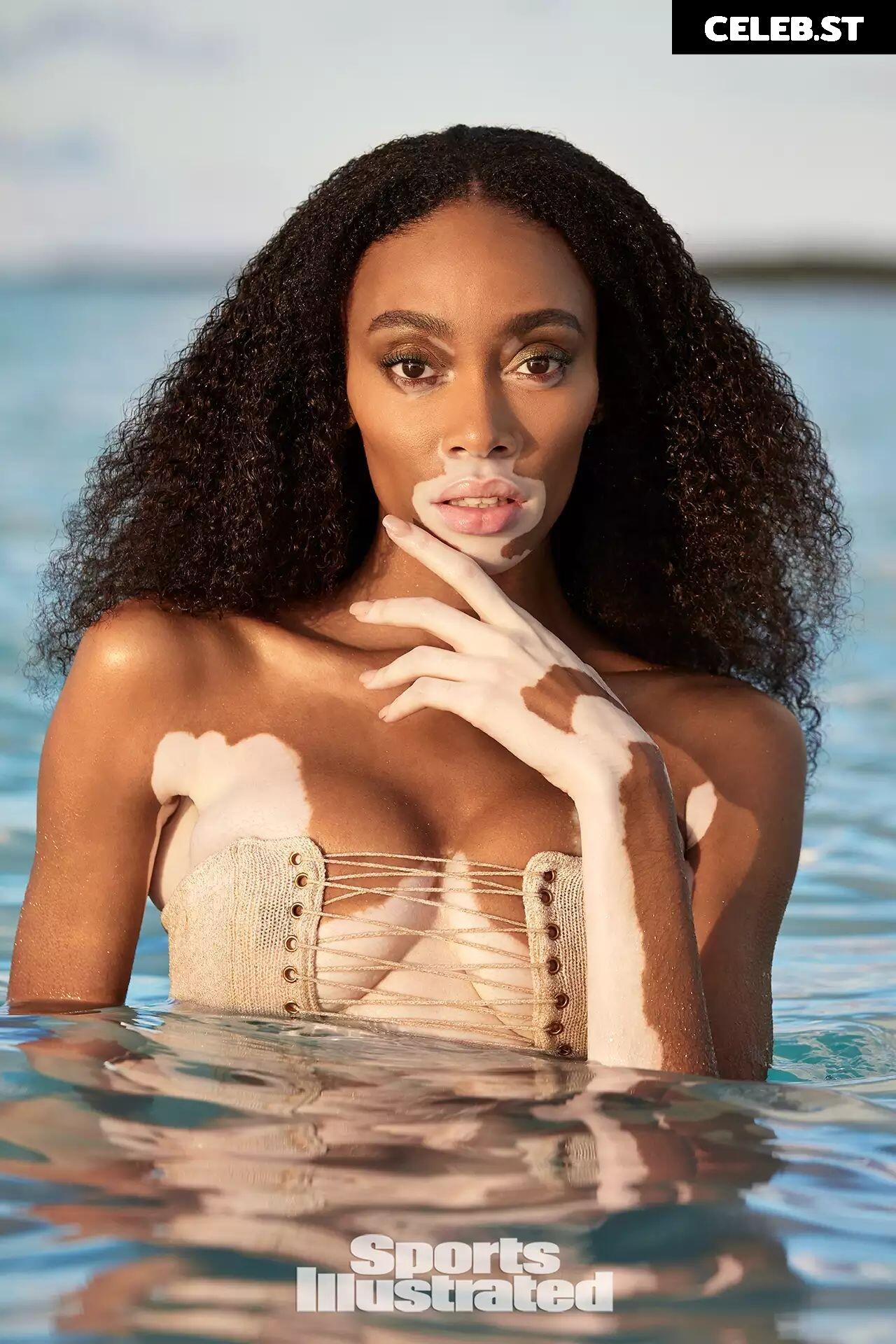 Winnie Harlow Image 1729827