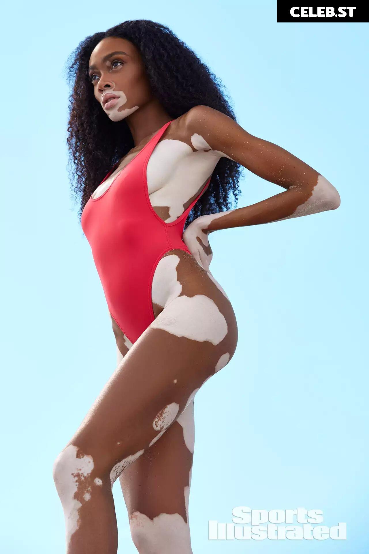 Winnie Harlow Image 1729547