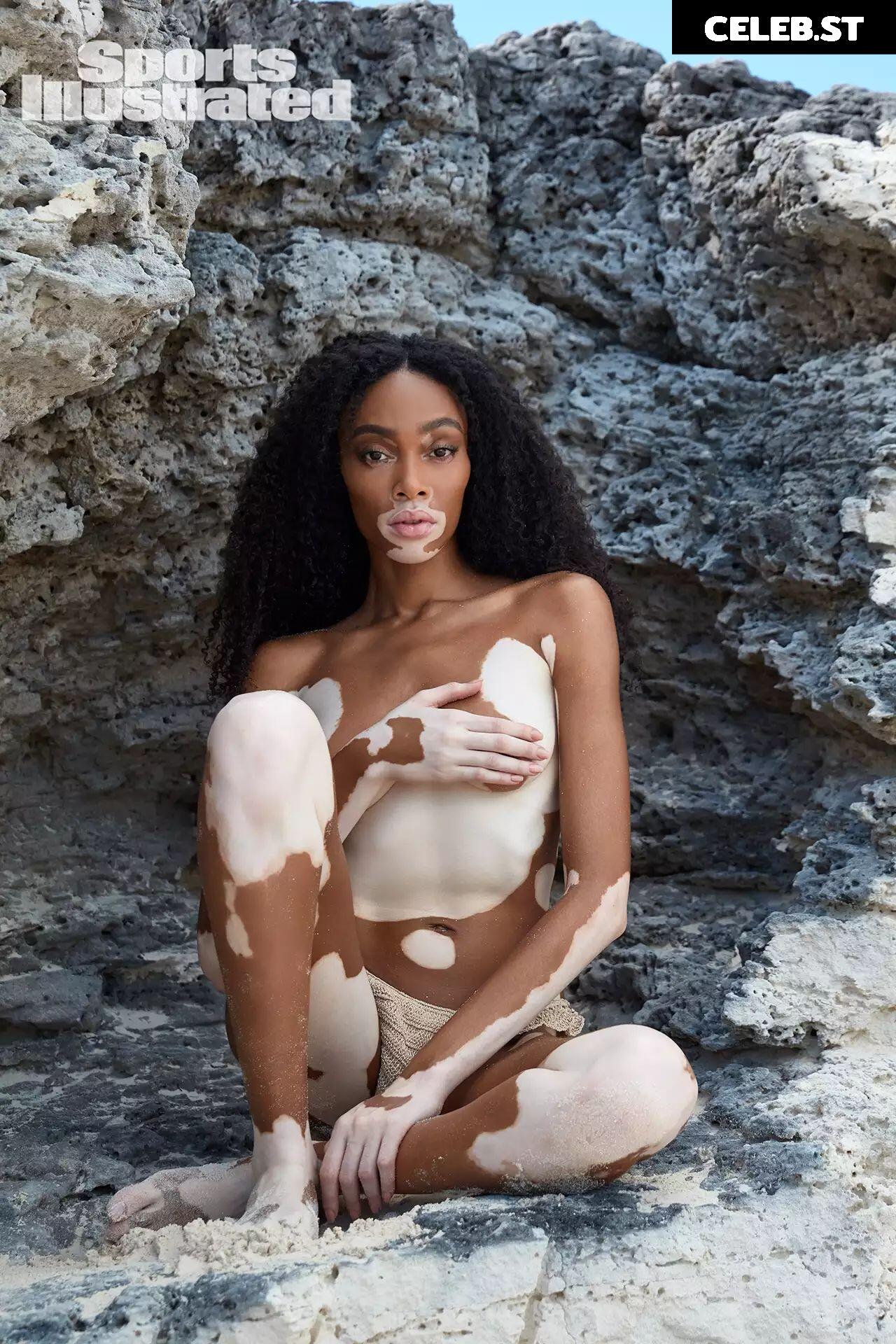 Winnie Harlow Image 1729472