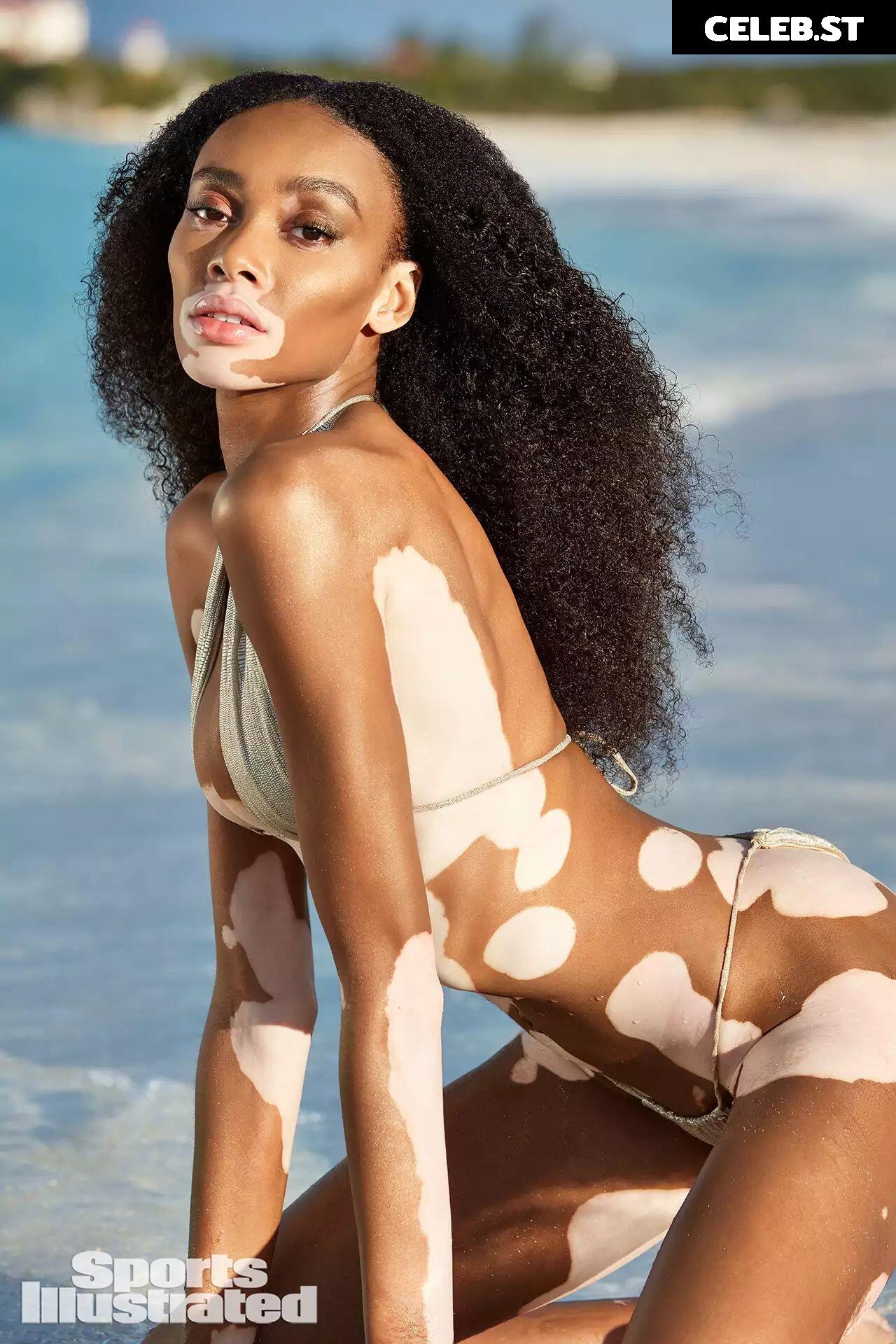 Winnie Harlow Image 1729699