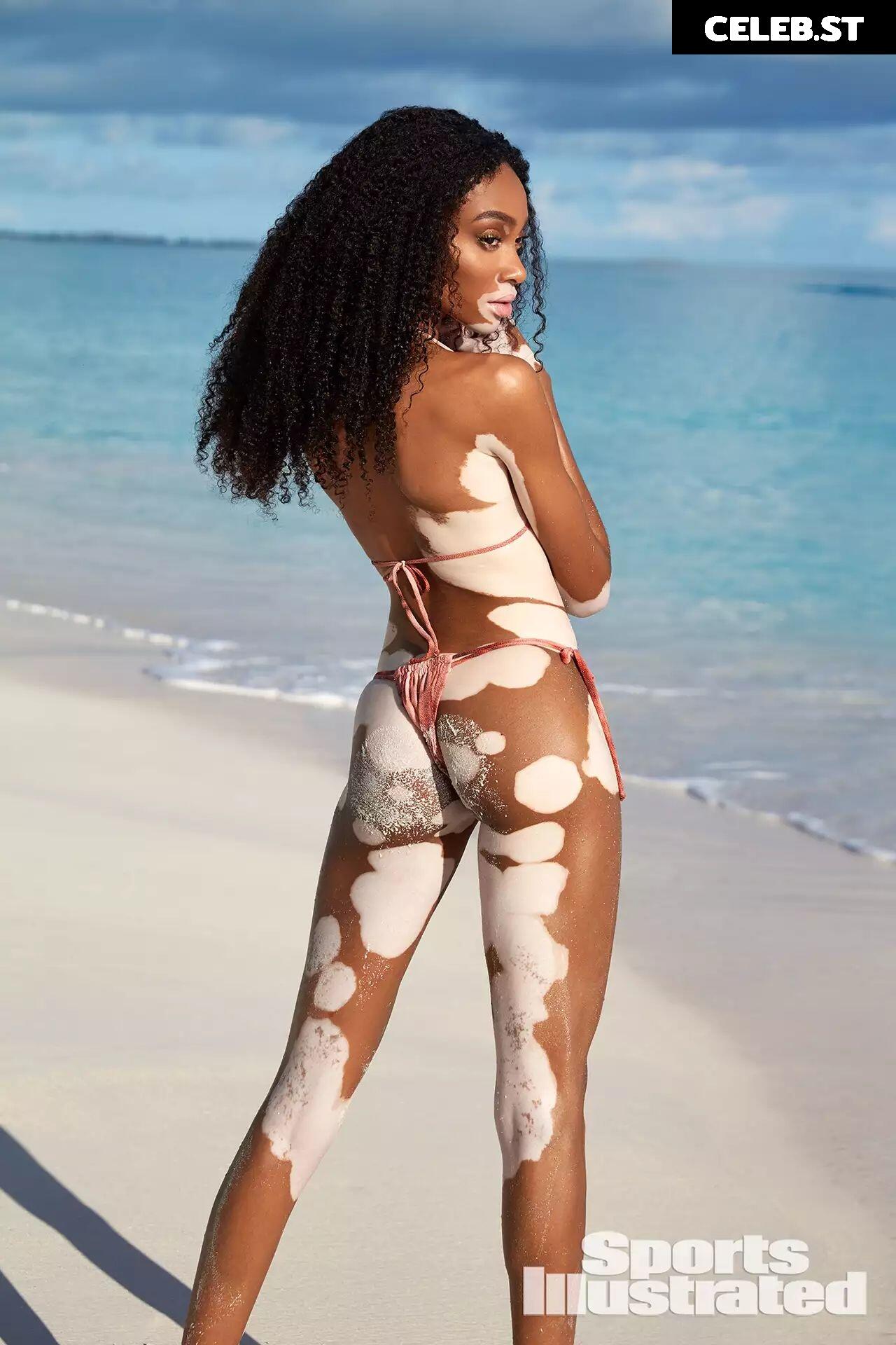 Winnie Harlow Image 1729996