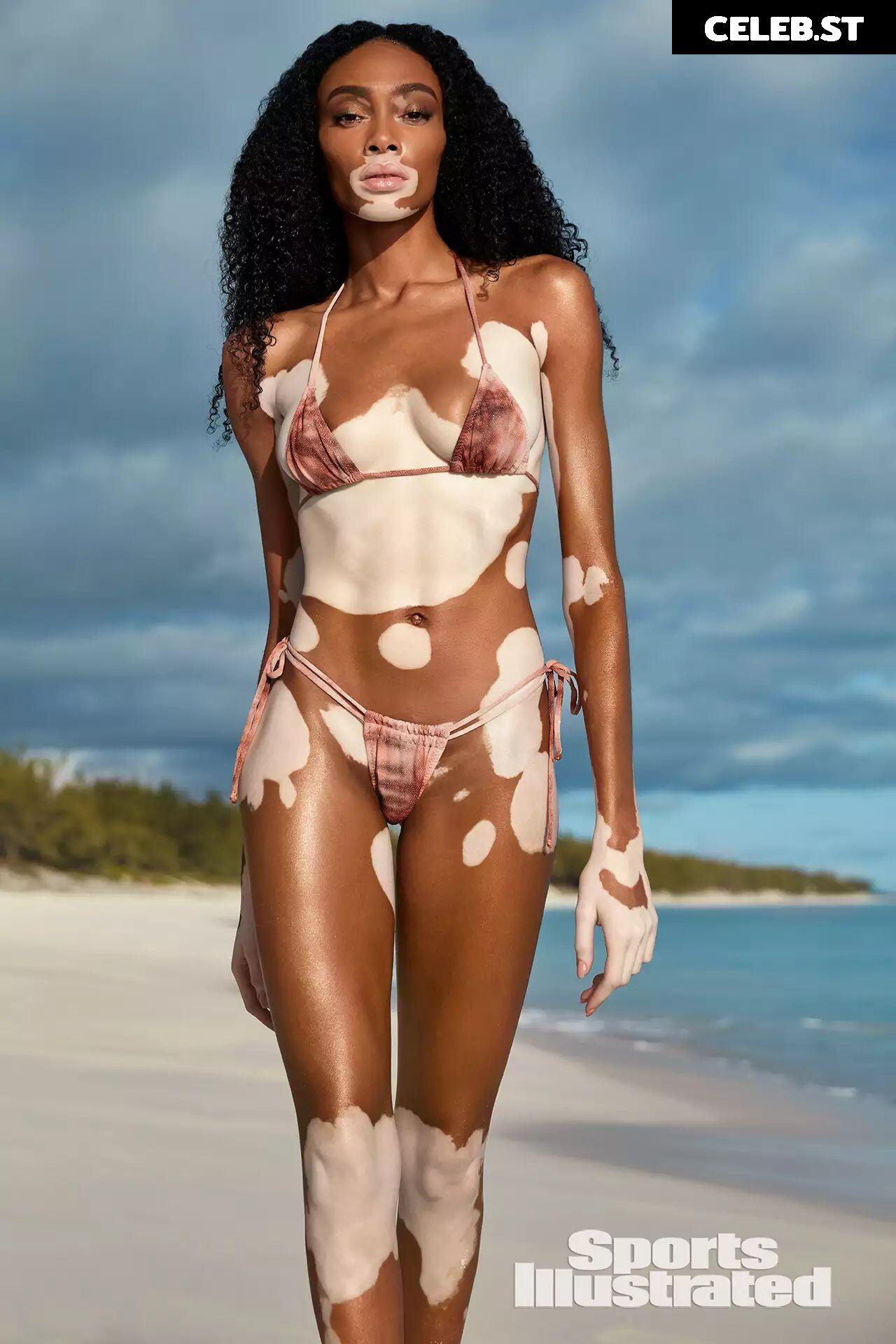 Winnie Harlow Image 1729922