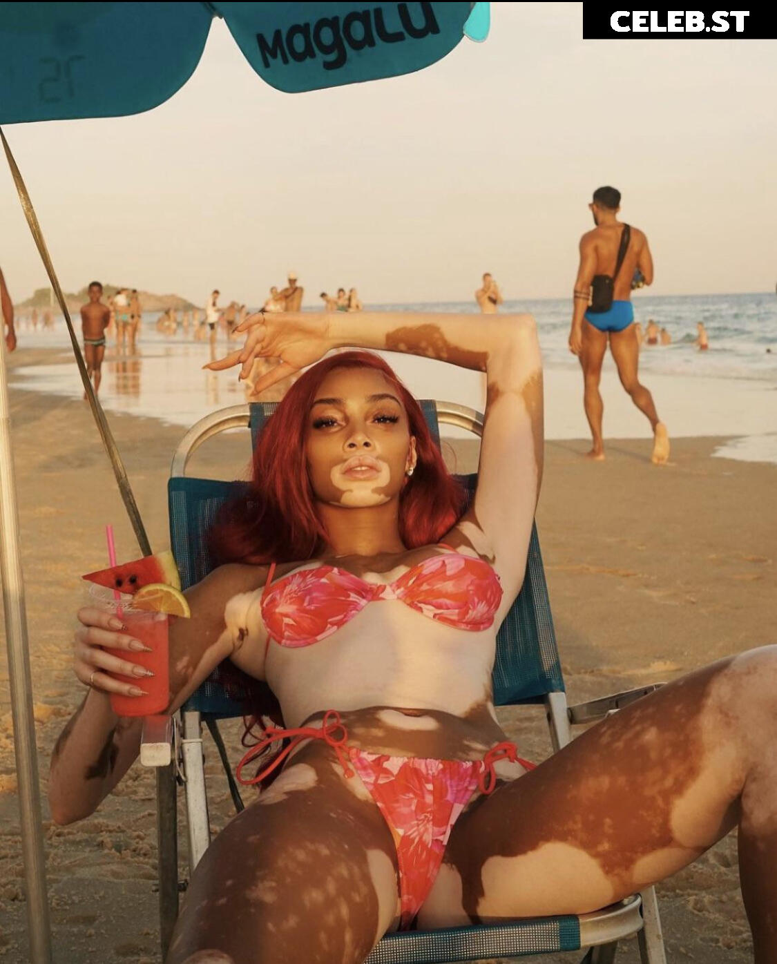 Winnie Harlow Image 1728588