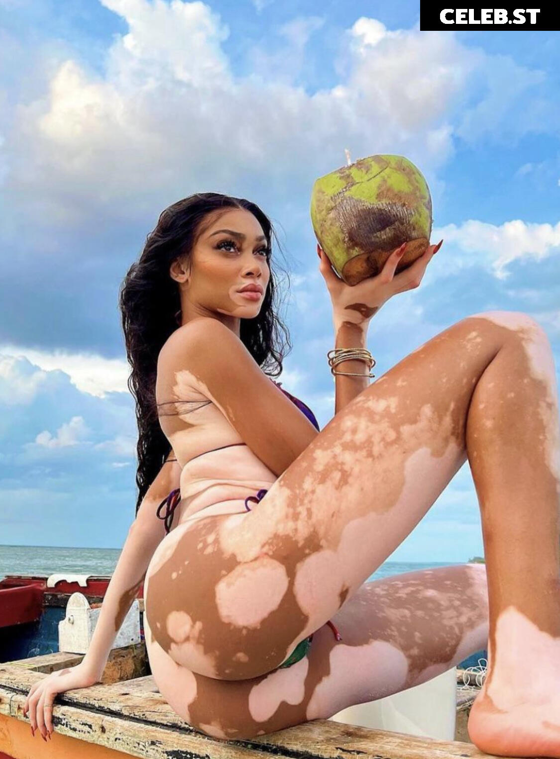 Winnie Harlow Image 1728539