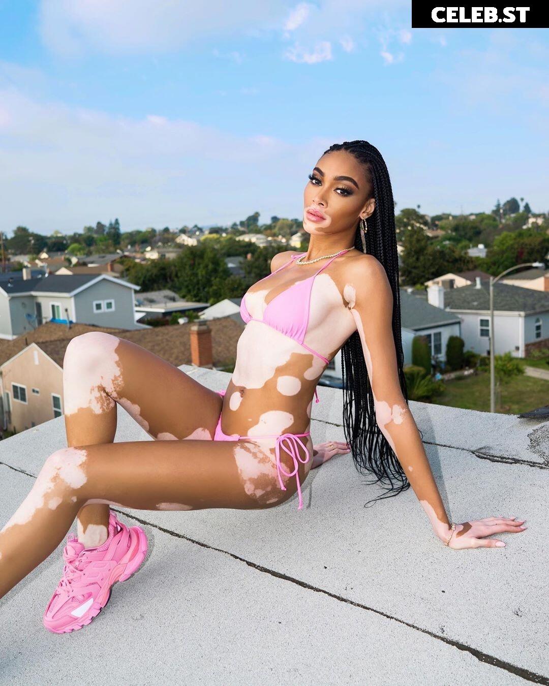 Winnie Harlow Image 1728400