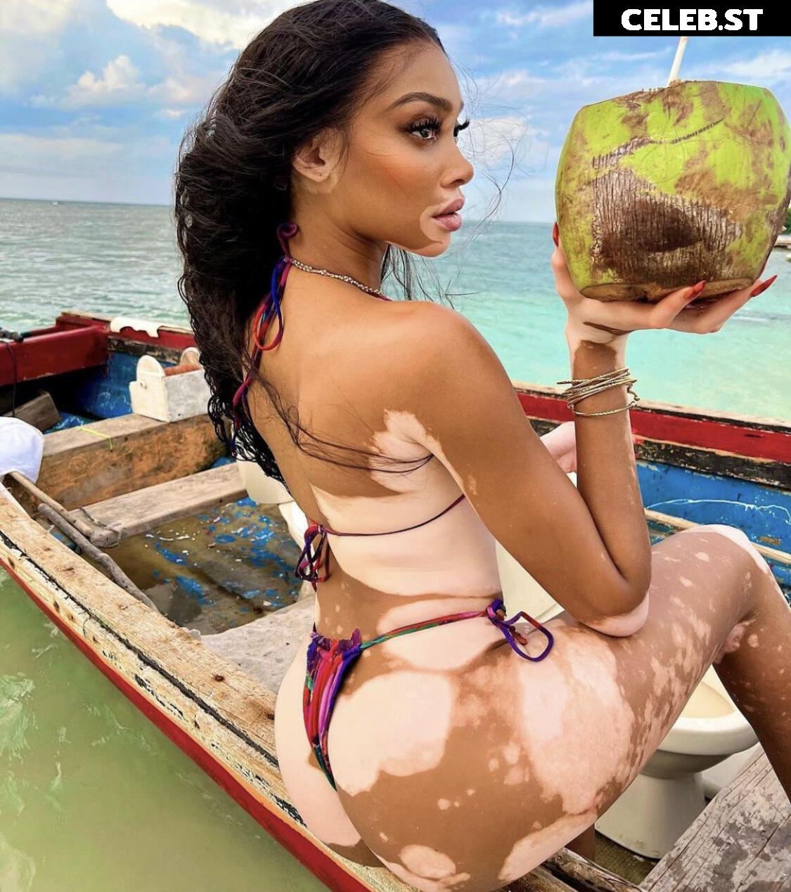 Winnie Harlow Image 1728434
