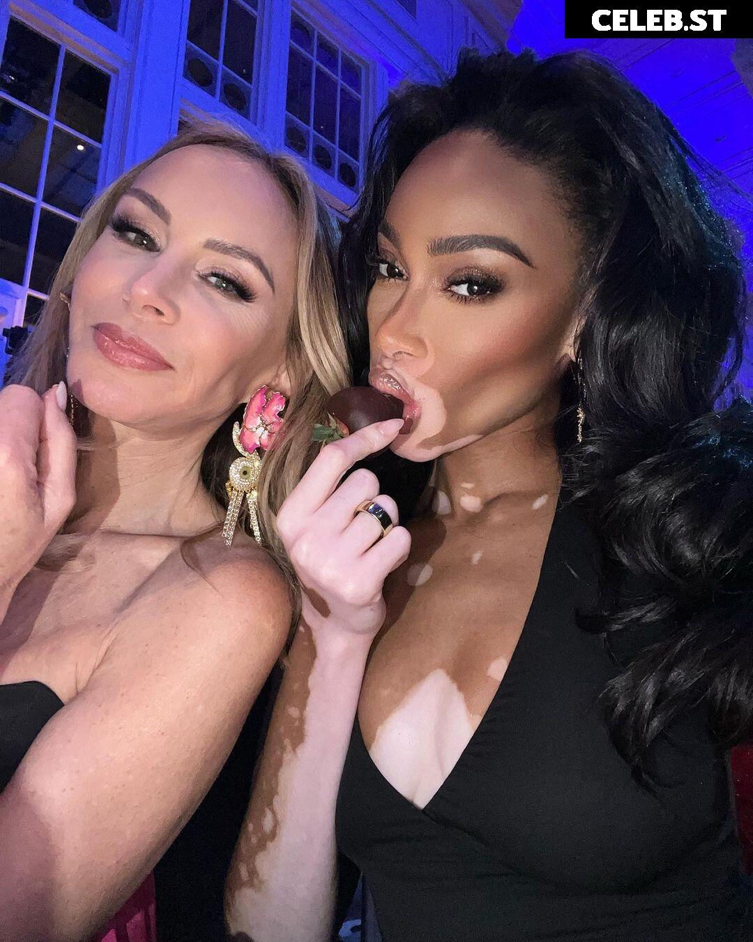 Winnie Harlow Image 1728786