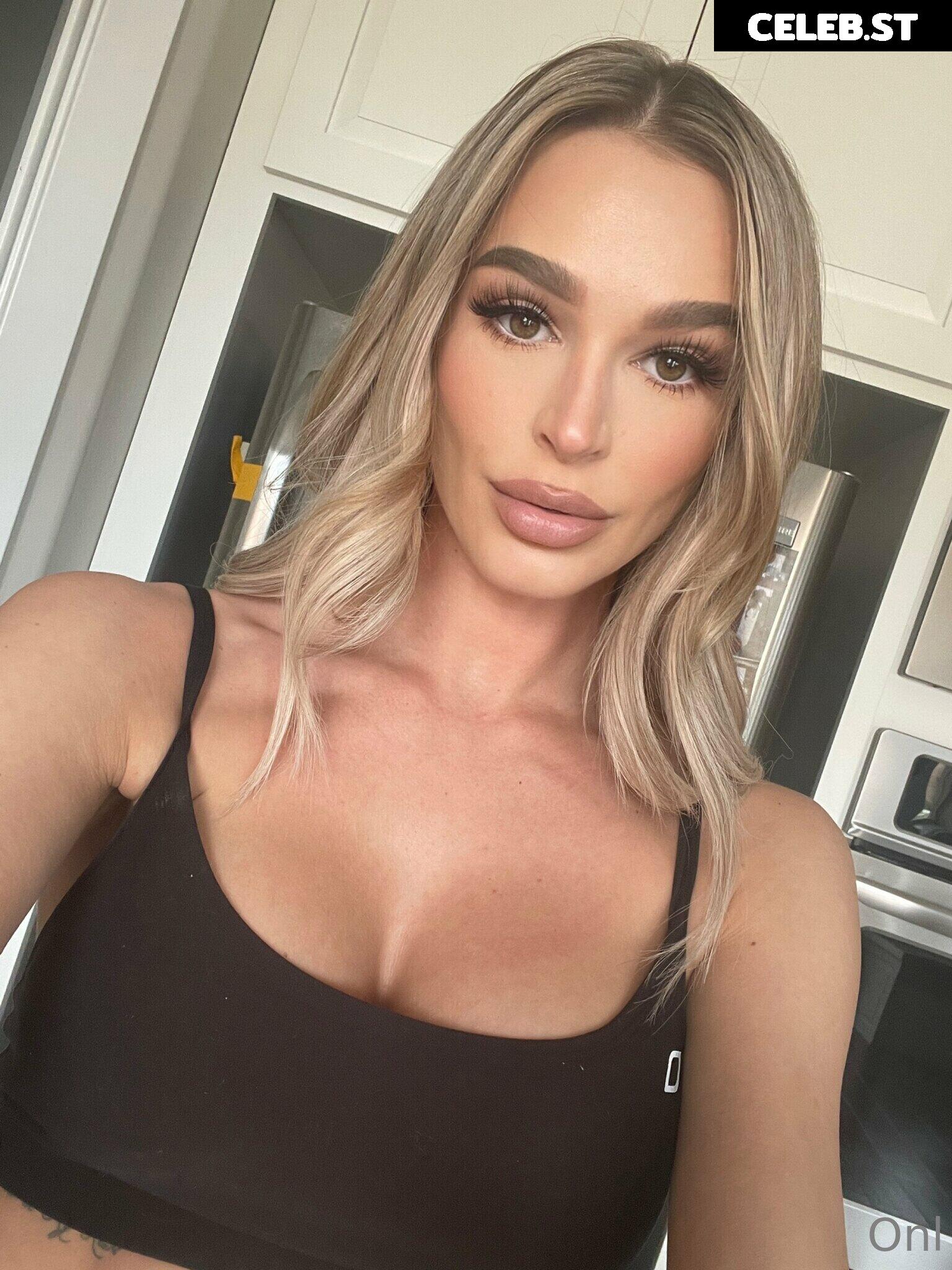 Emma Hix / emmahixofficial Image 10952345