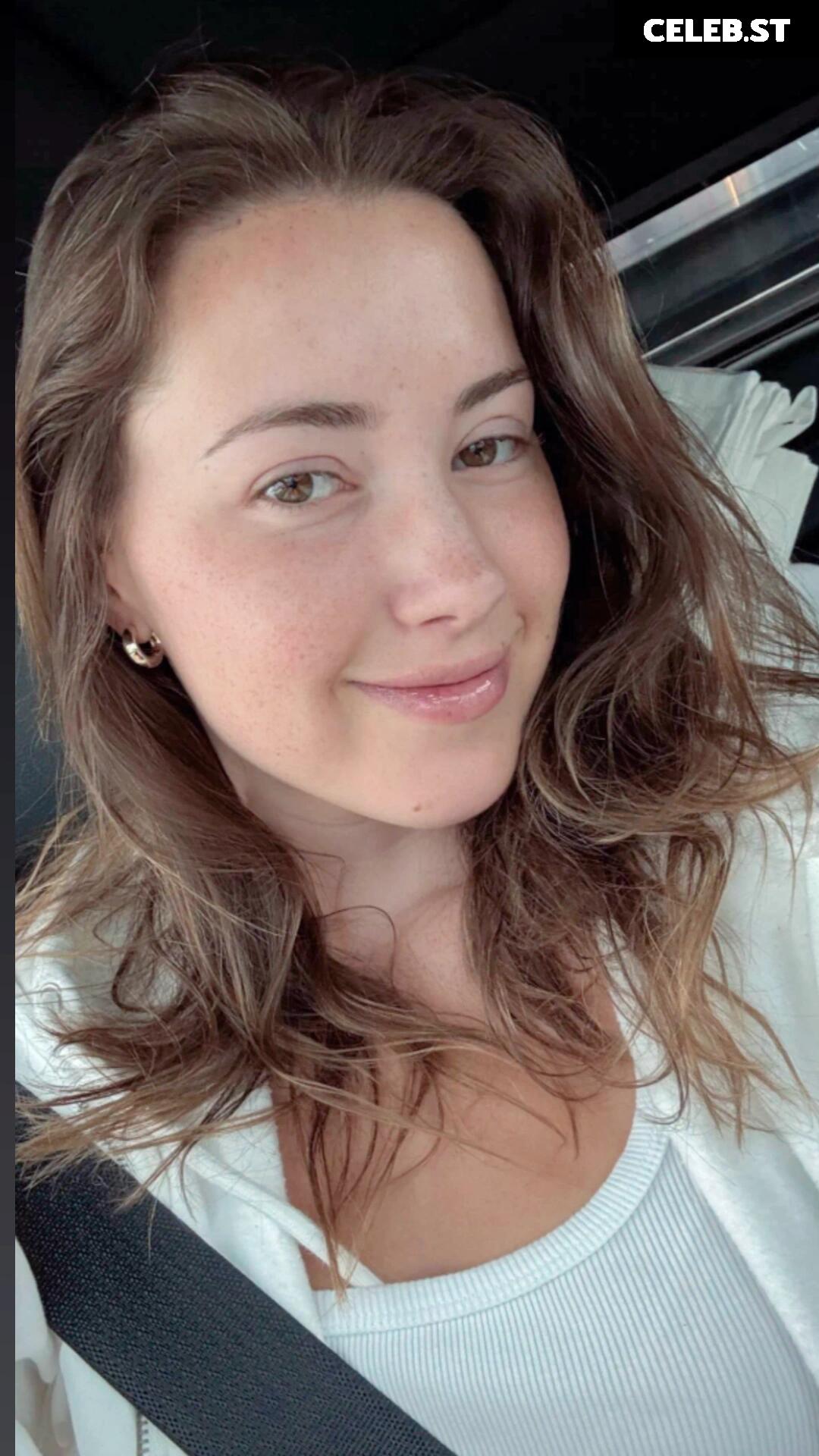 Pineapplebrat / Alice Klomp Image 10786262