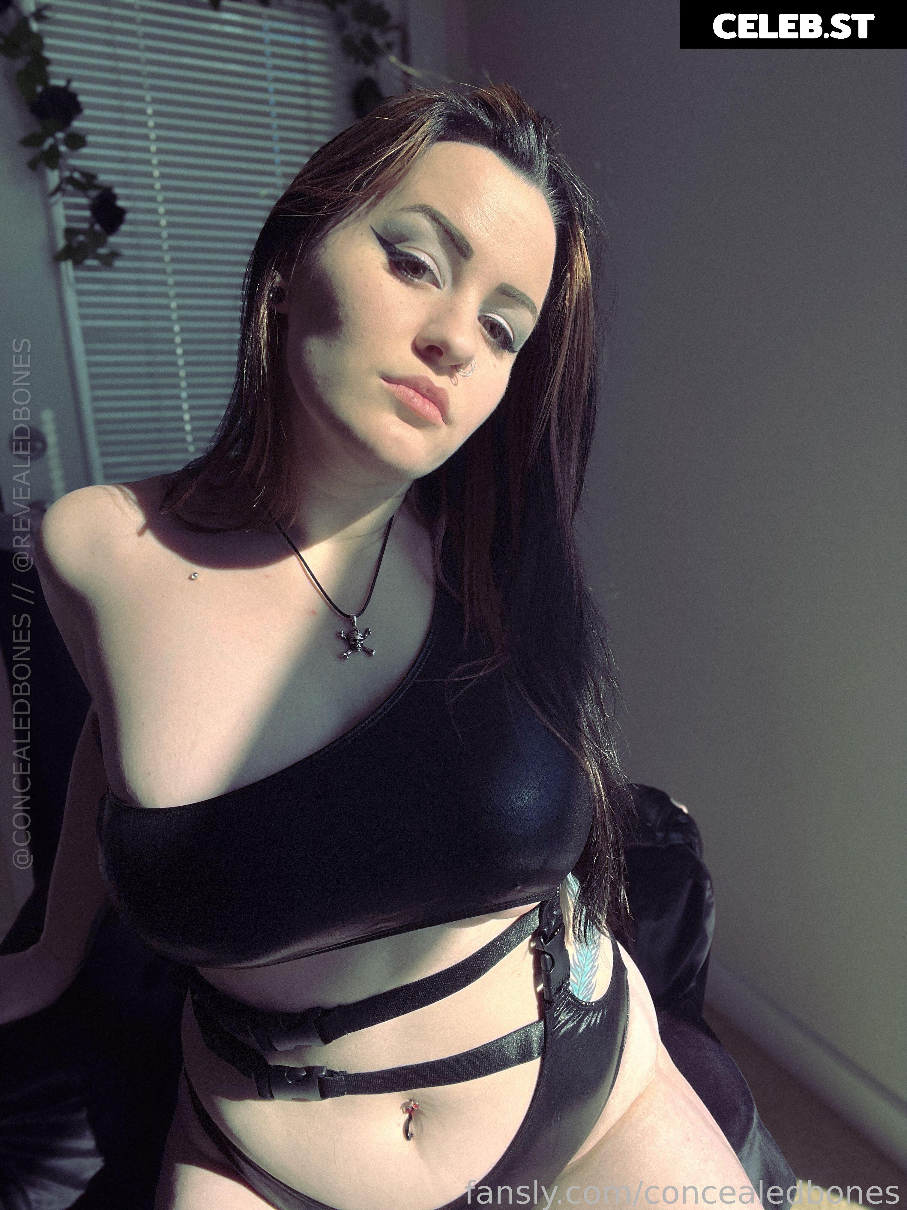 ConcealedBones Image 10615896