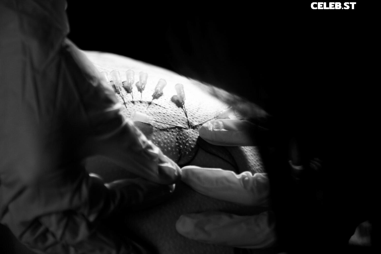 Calvato Photography - Patreon Image 3157769