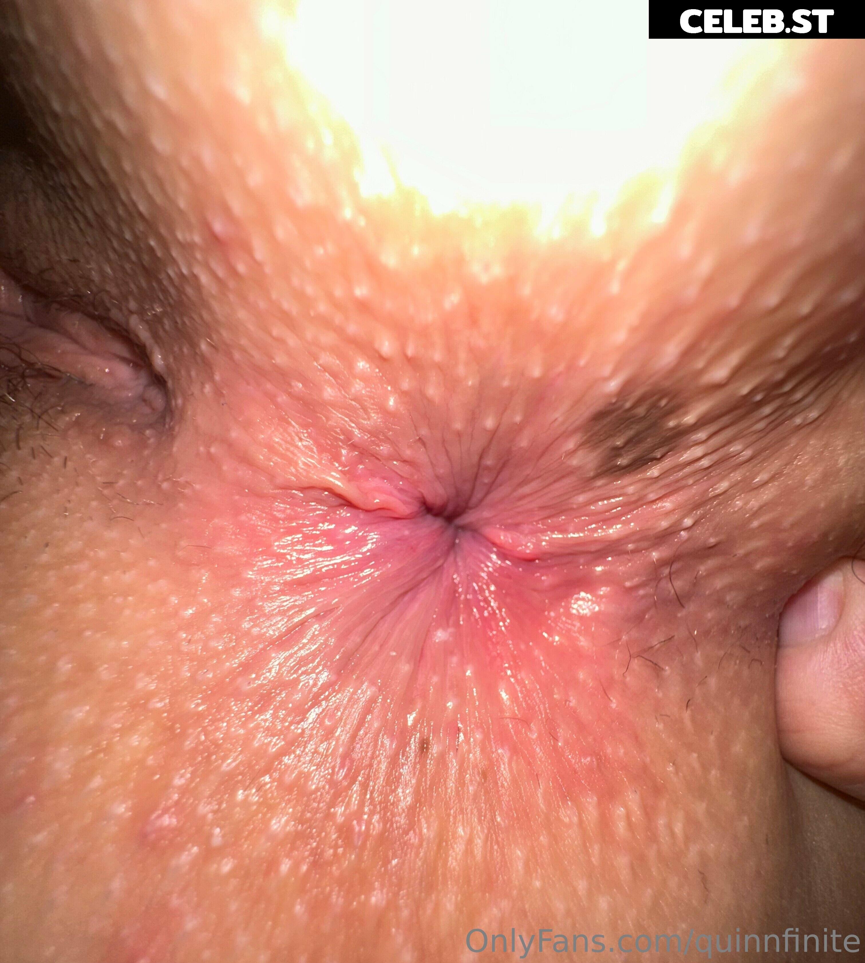 Quinn Finite Image 3139217