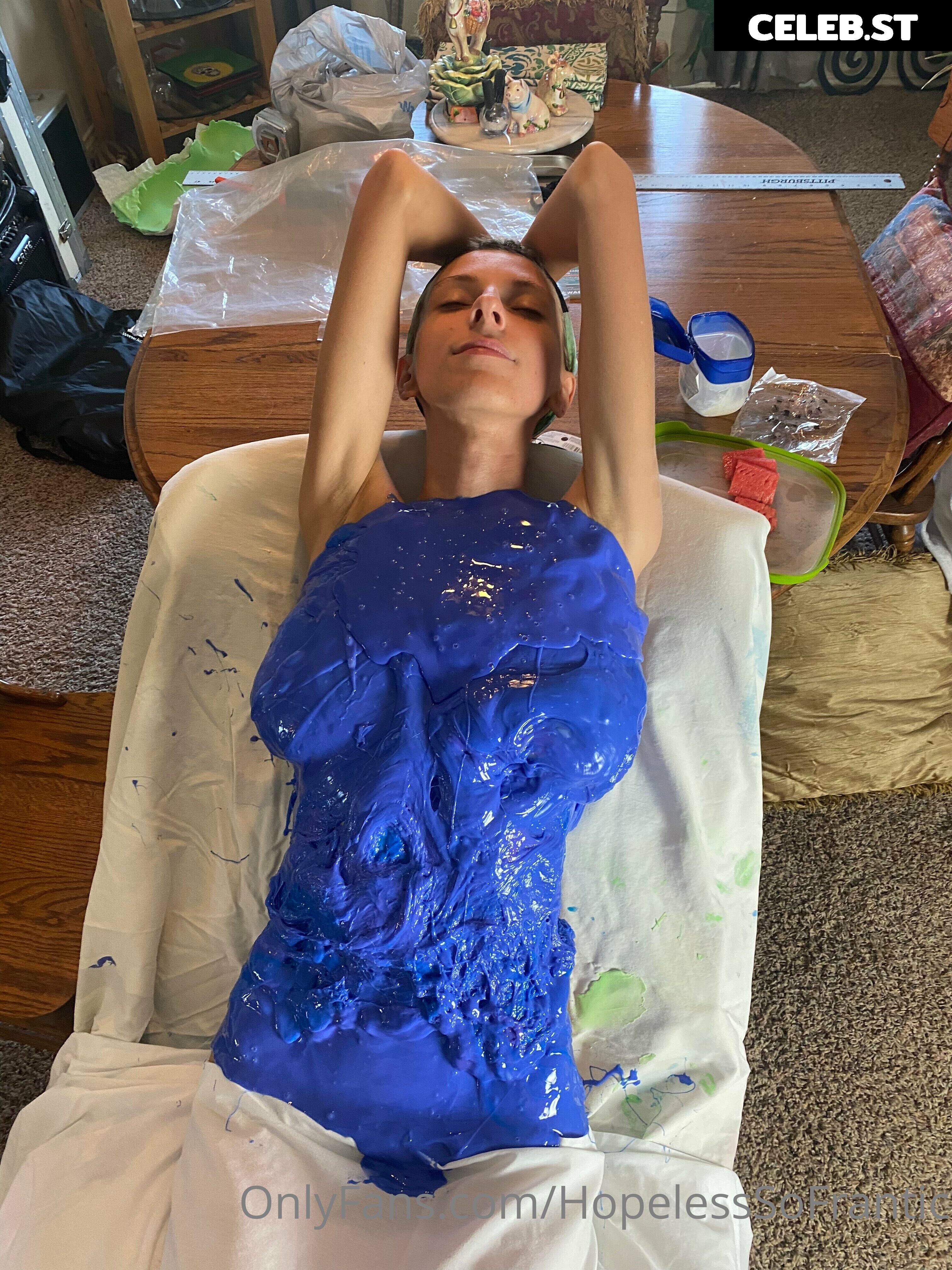 Hopelesssofrantic Image 3691805