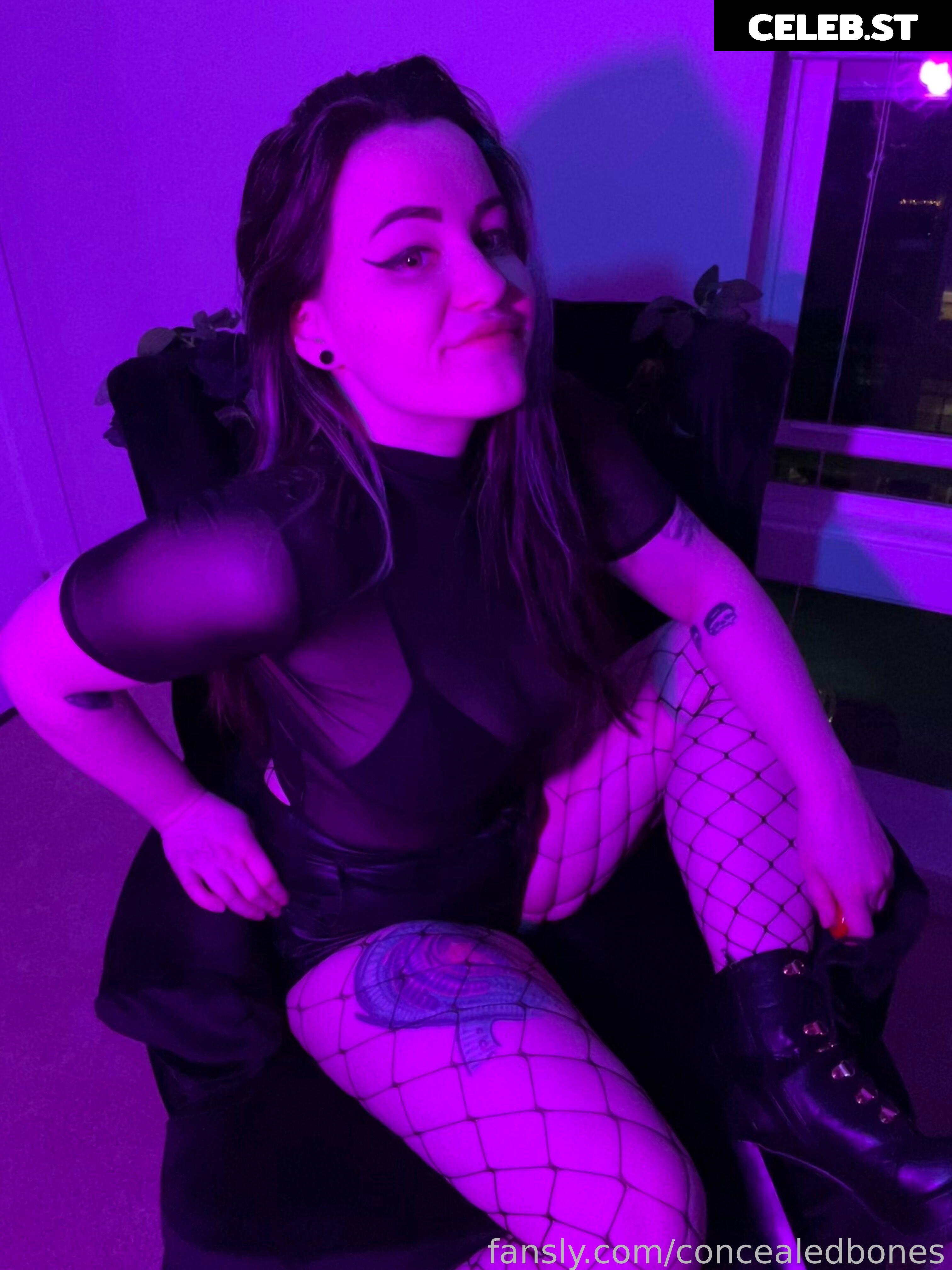 ConcealedBones Image 3657982