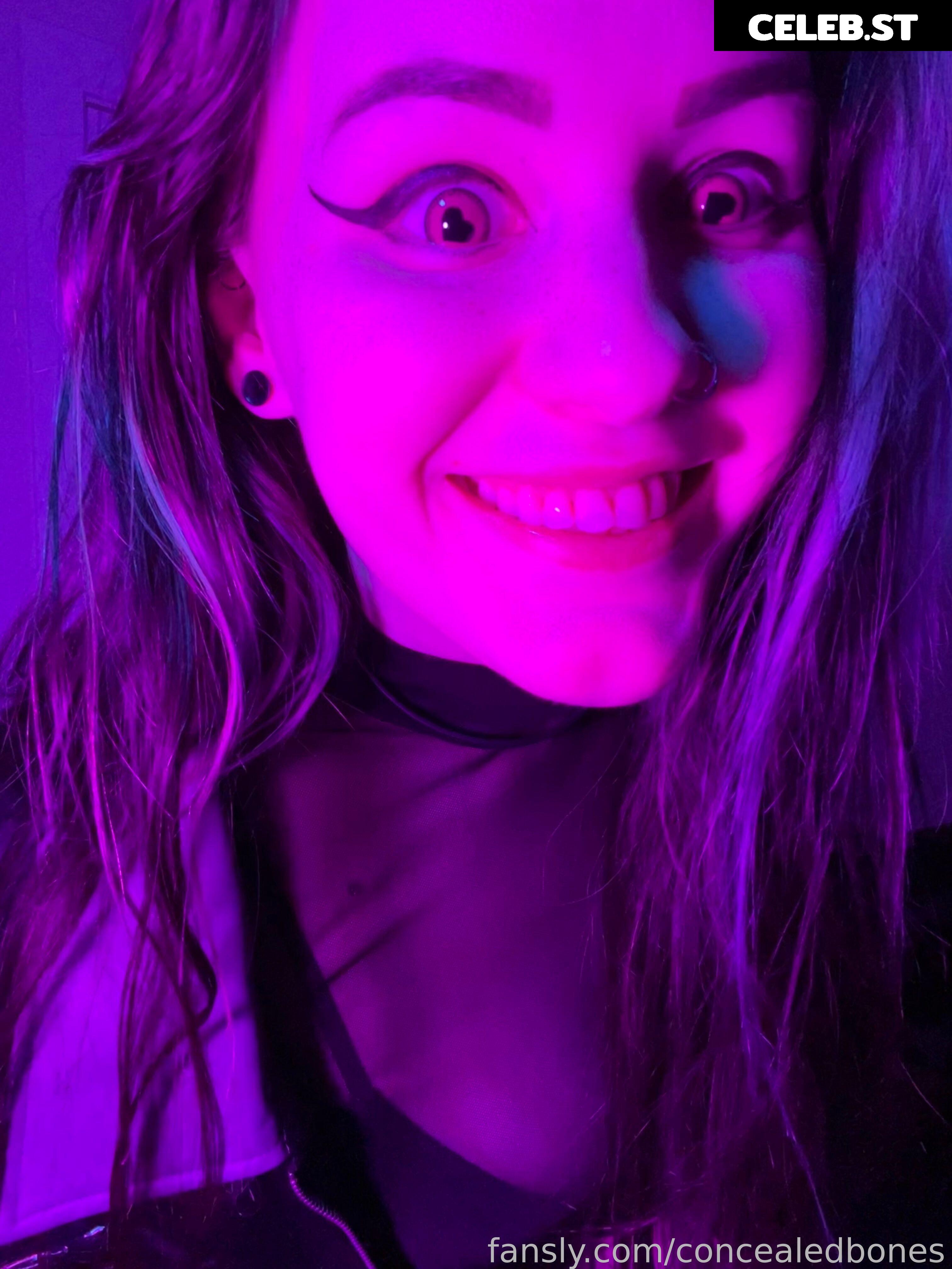 ConcealedBones Image 3657928