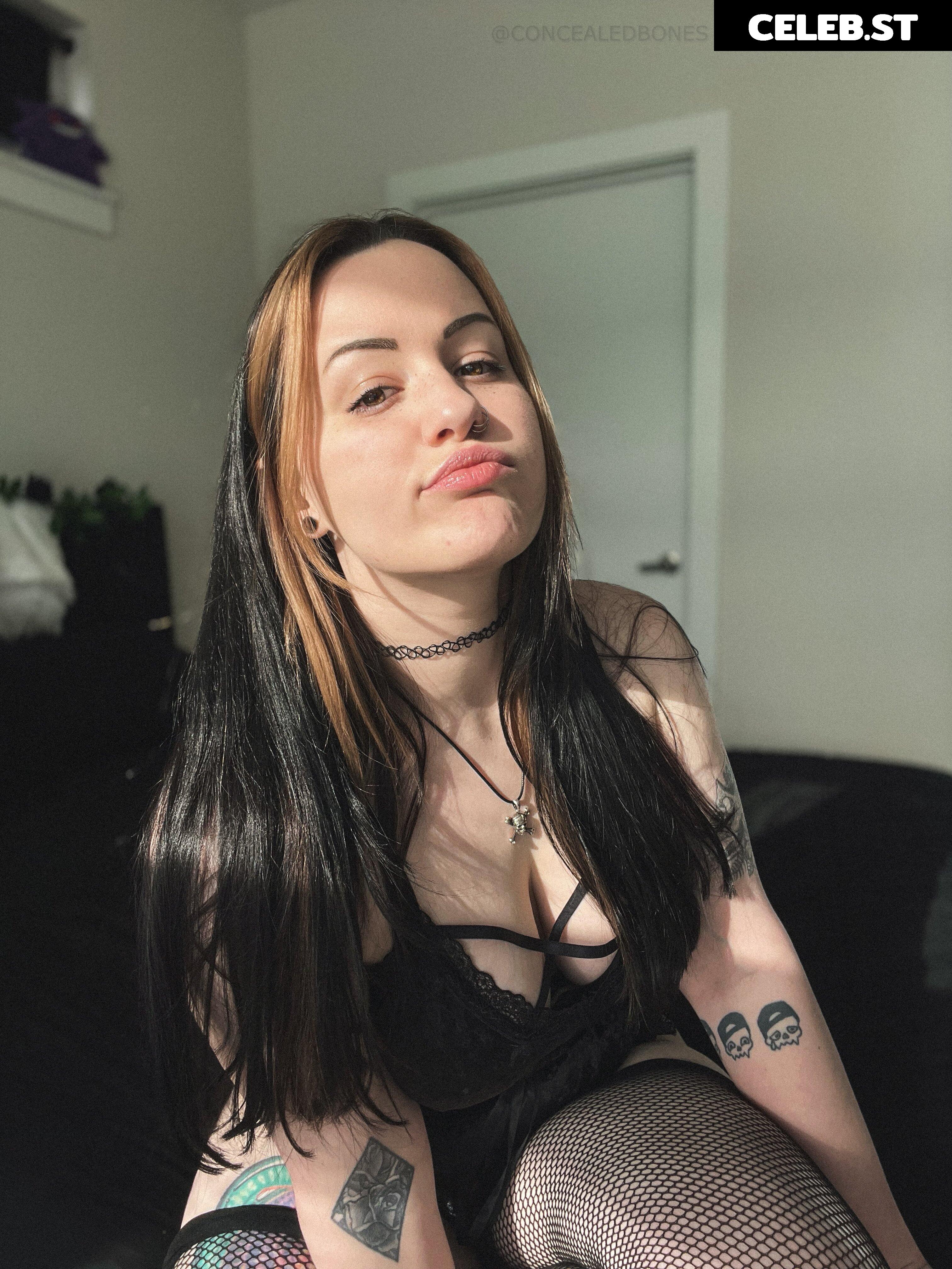 ConcealedBones Image 3650135