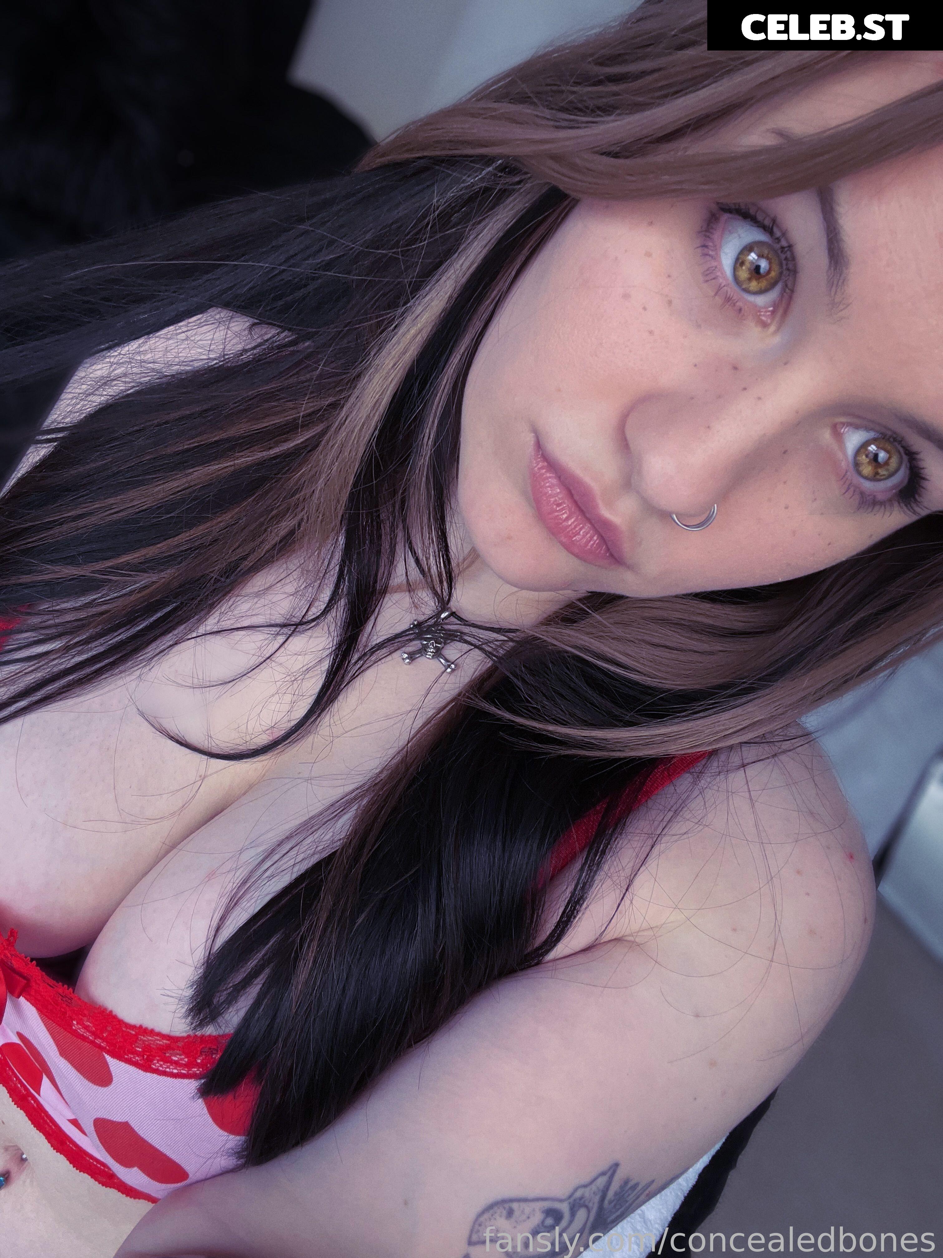 ConcealedBones Image 3659166