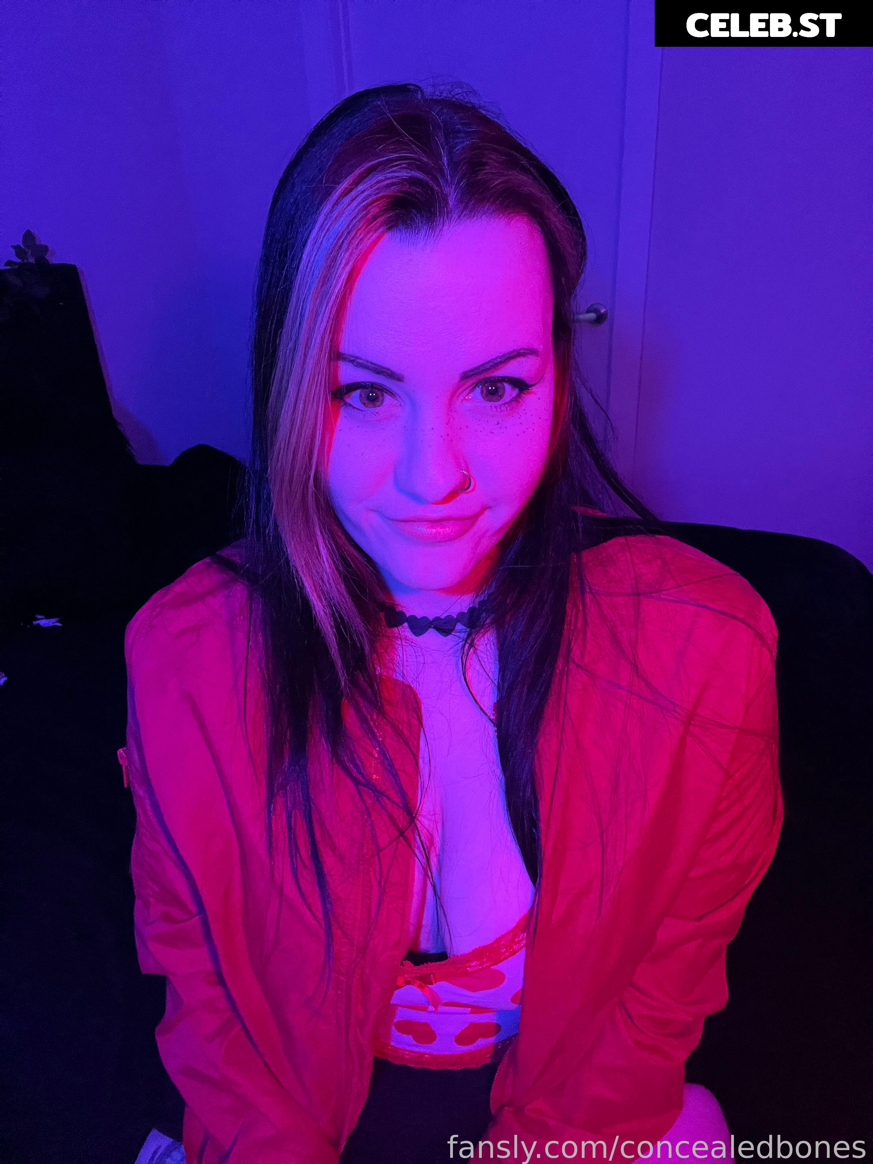 ConcealedBones Image 3658982