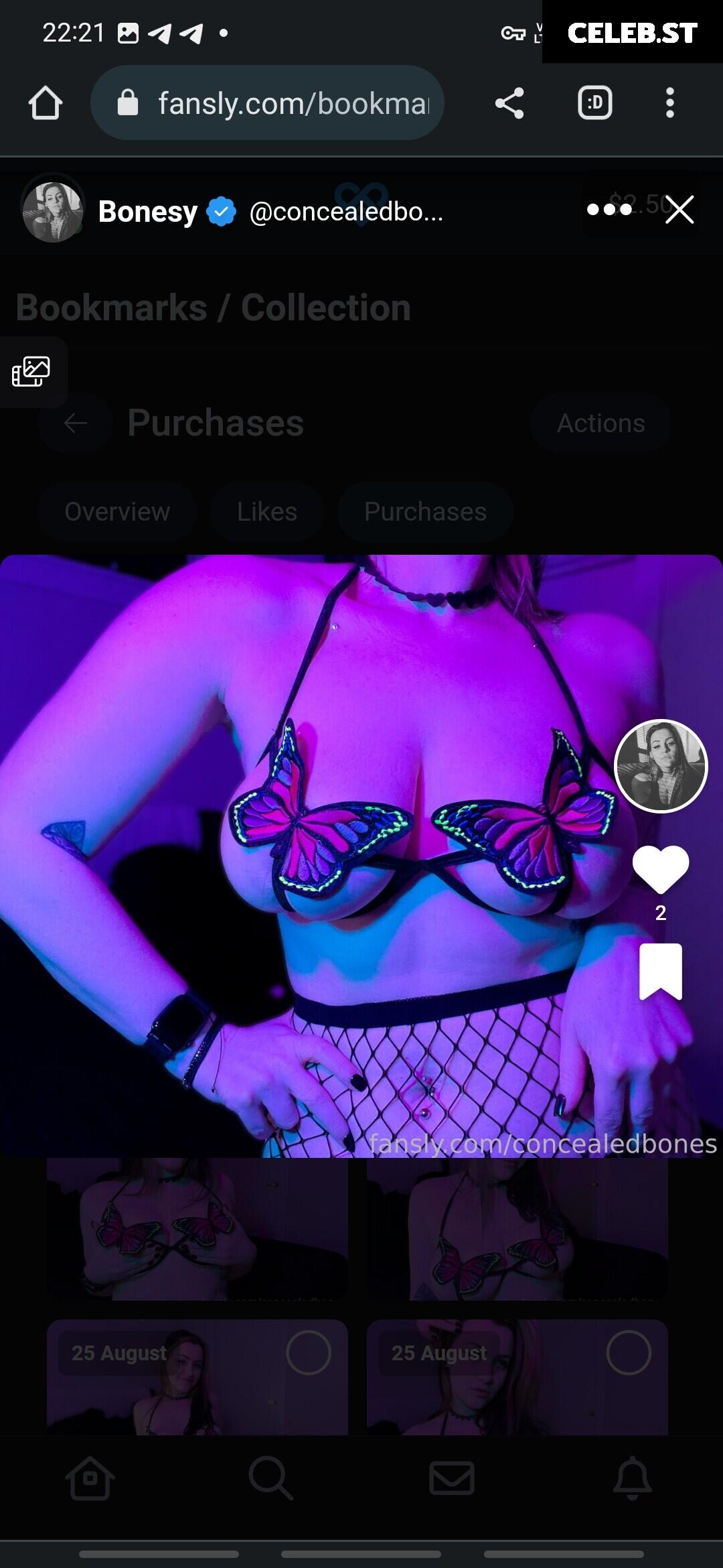 ConcealedBones Image 3646162