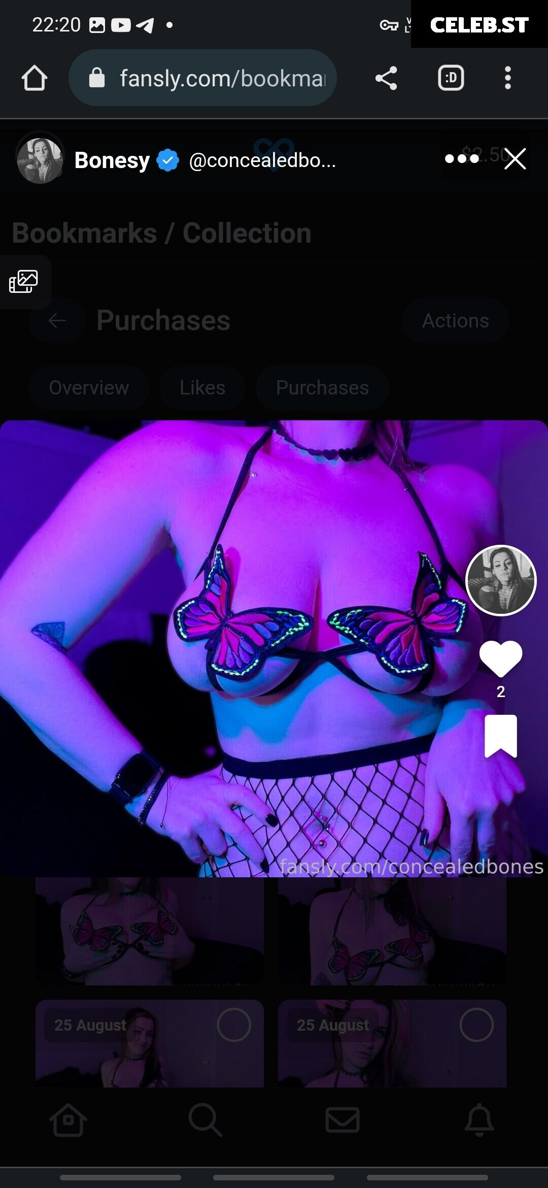 ConcealedBones Image 3646356