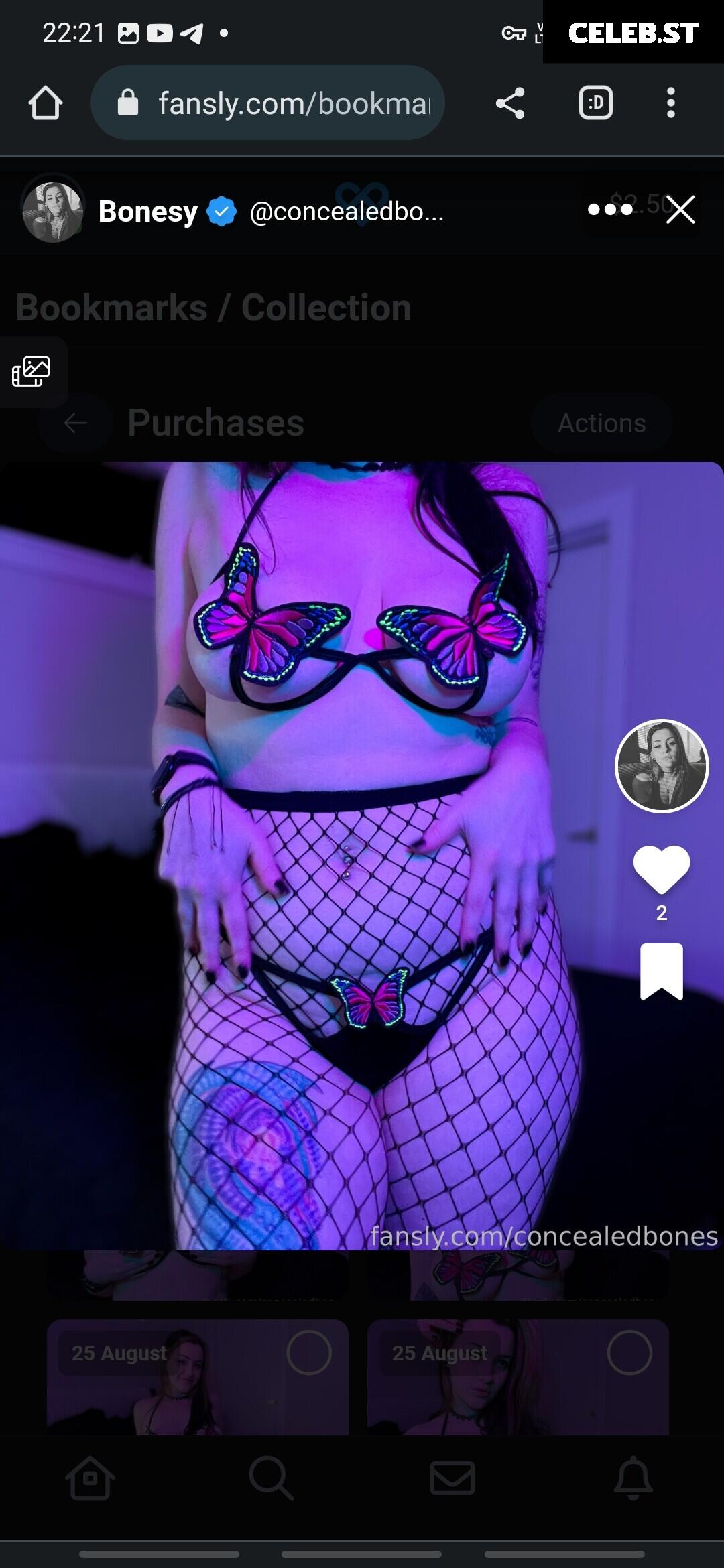 ConcealedBones Image 3646340