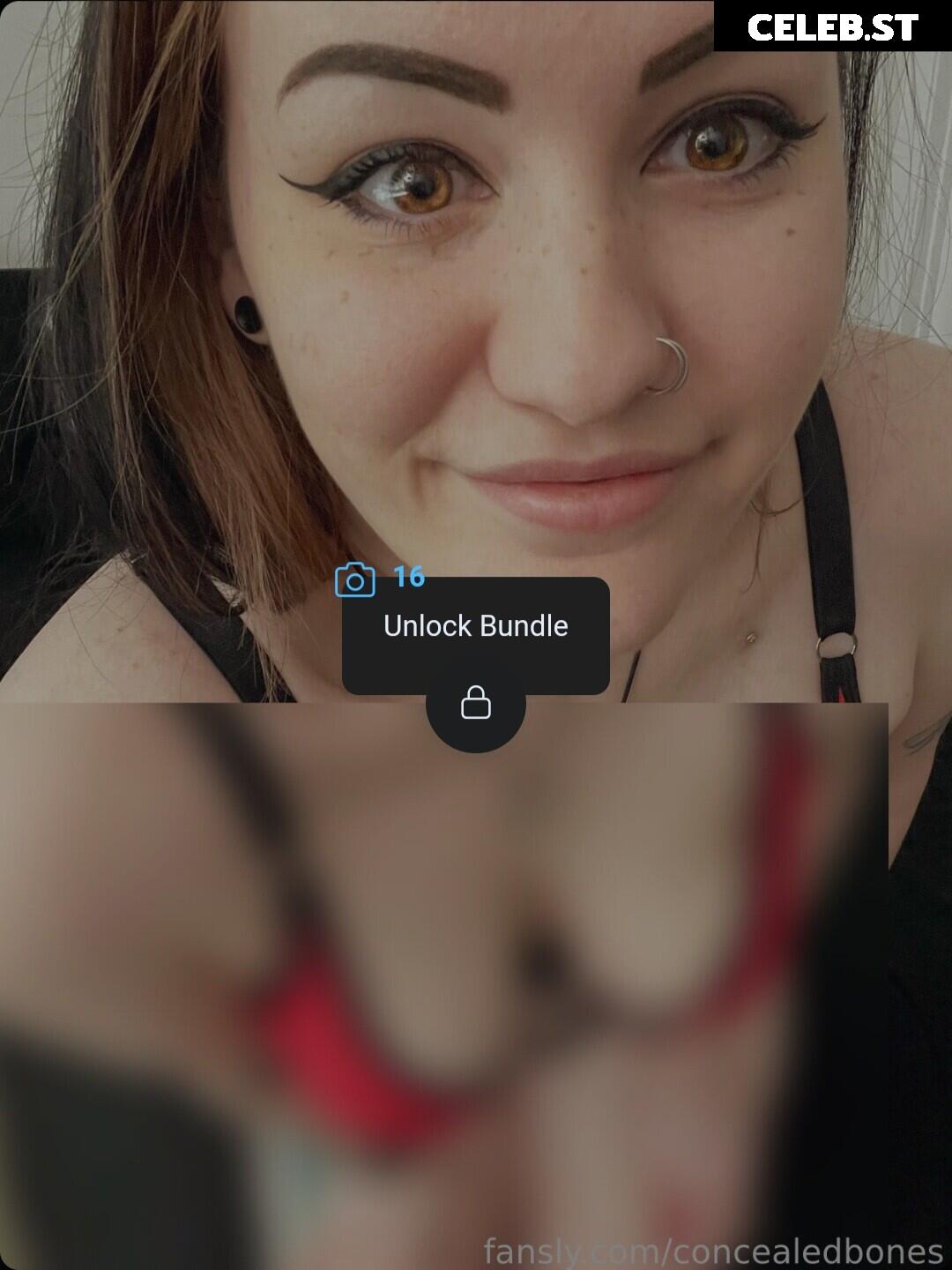 ConcealedBones Image 3648387