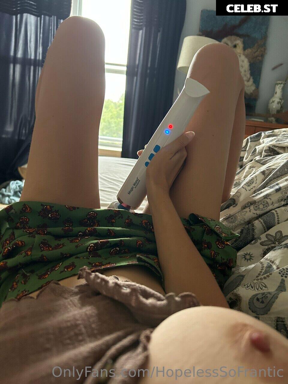 Hopelesssofrantic Image 3705518