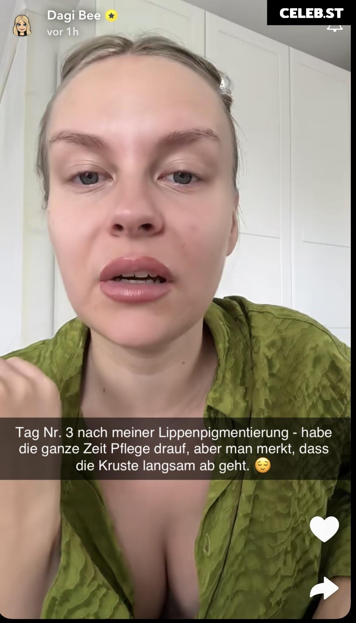 Dagi Bee Image 666145