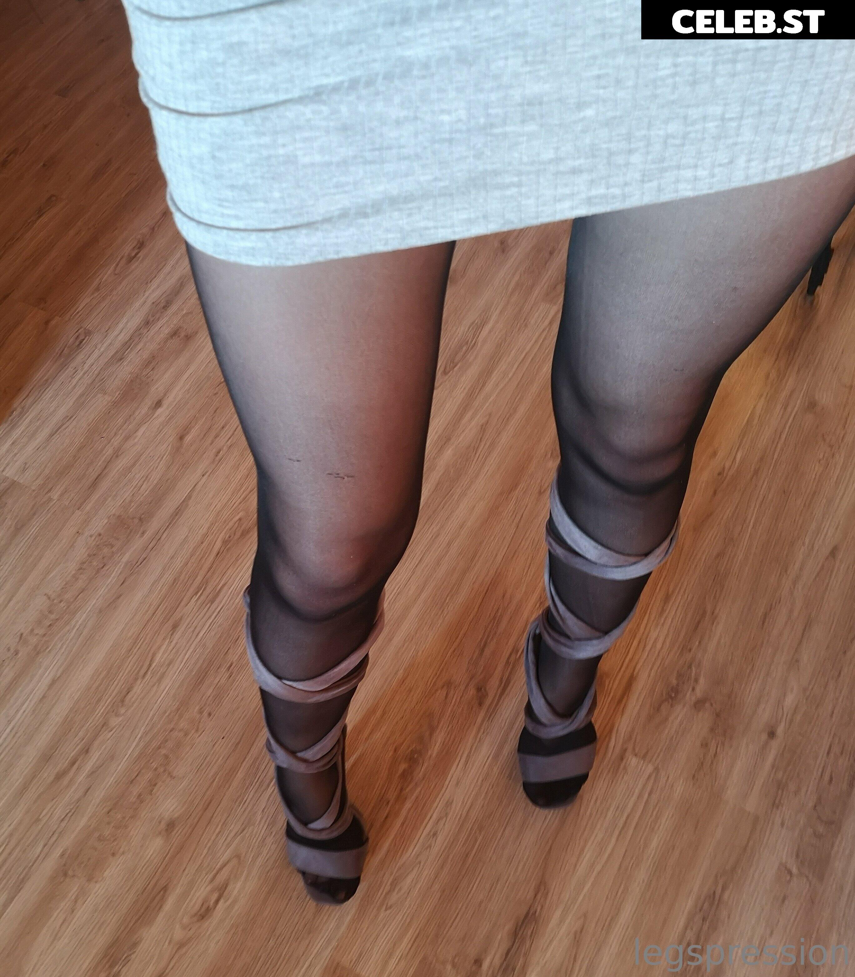 Mytightfashion Image 560296