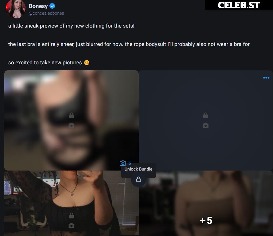 ConcealedBones Image 4352287