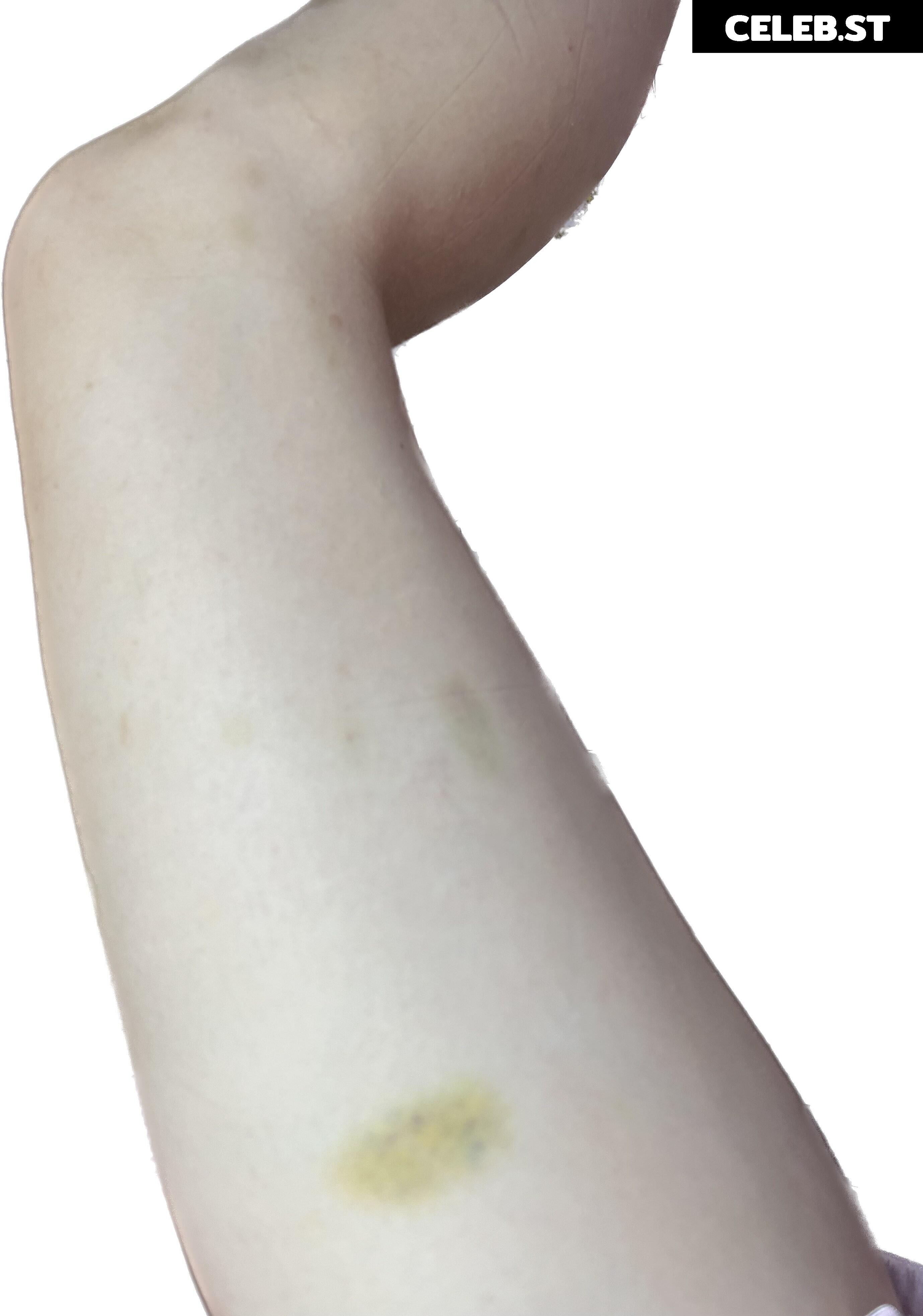 inislein Image 4300516