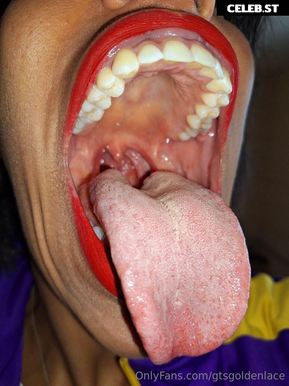 Goldenlace Image 4002888