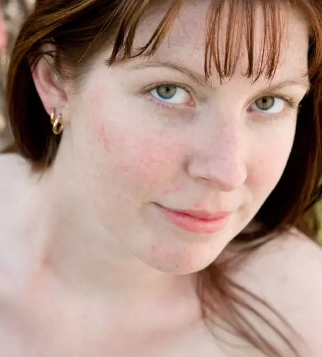 Image 9991859 from Abbywinters