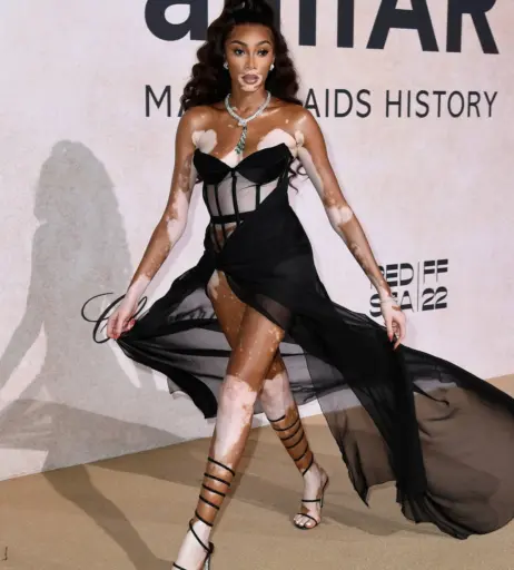 Image 9957290 from Winnie Harlow