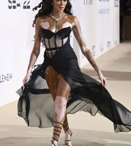 Image 9957288 from Winnie Harlow