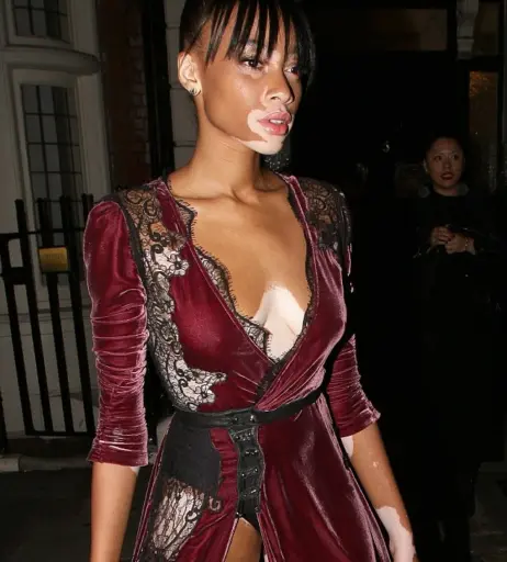 Image 9943744 from Winnie Harlow