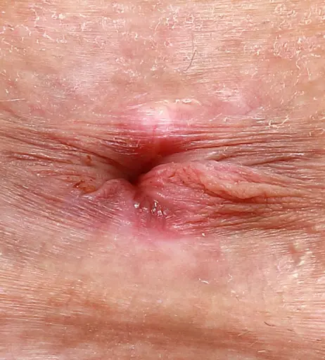 Image 23239030 from Kali Roses