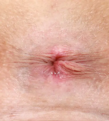 Image 23239315 from Kali Roses