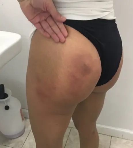 Image 23088791 from Amanda Serrano / Puerto Rican Boxer