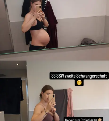 Image 27171577 from Pregnant