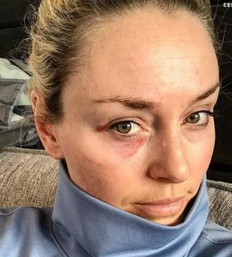 Image 2068559 from Lindsey Vonn