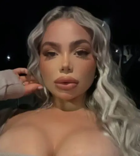 Image 11969699 from Garciaastepph